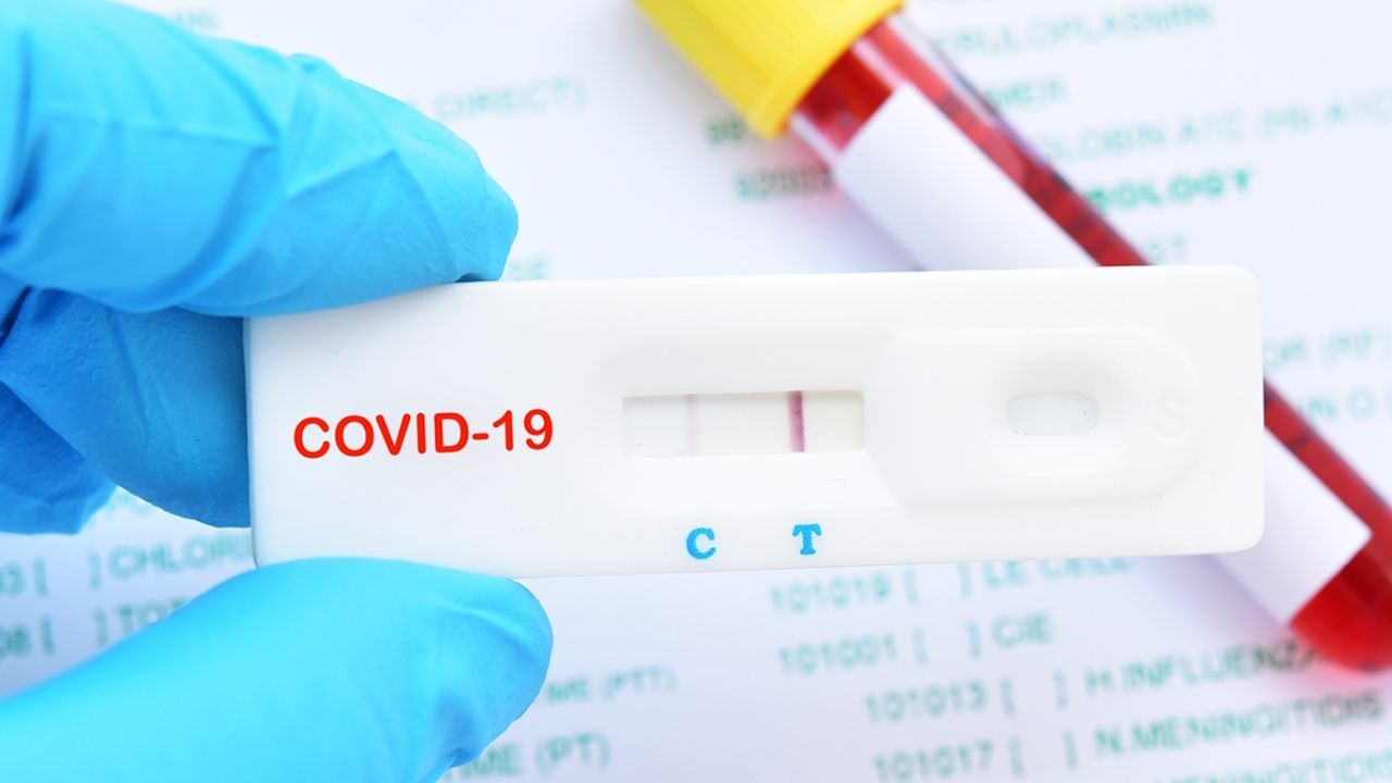 Δωρεάν Rapid test σε επιχειρηματίες και ελεύθερους επαγγελματίες.