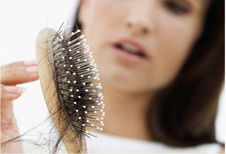 Severe hair loss. How do you report it to your client?
