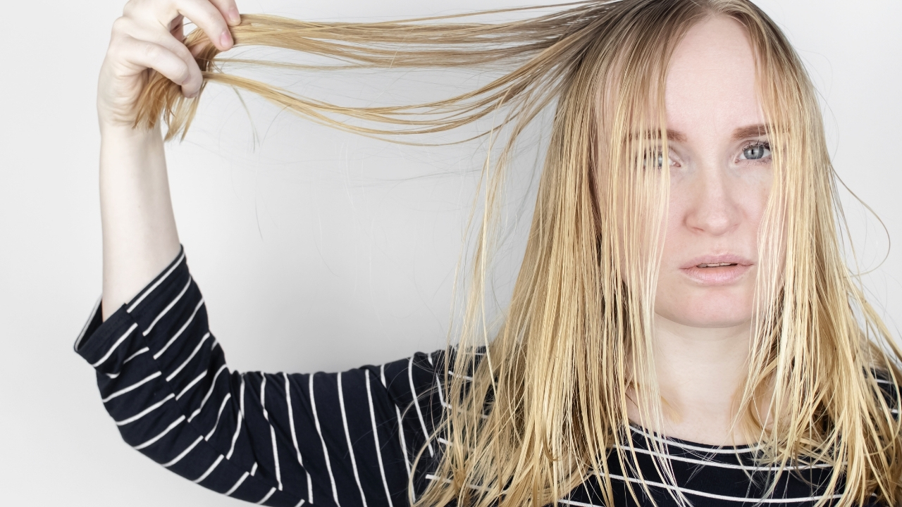 Oily hair- Treat it in 10 ways!